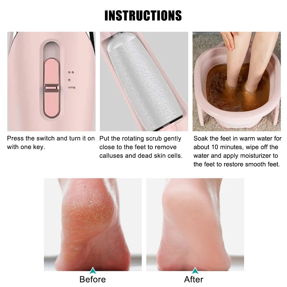 Rechargeable Electric Foot Callus Remover – Painless Pedicure Tool for Smooth, Soft Heels
